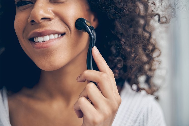 Best Dermarollers for Acne Scars
