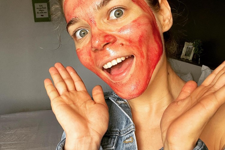 chemical peel aftercare
