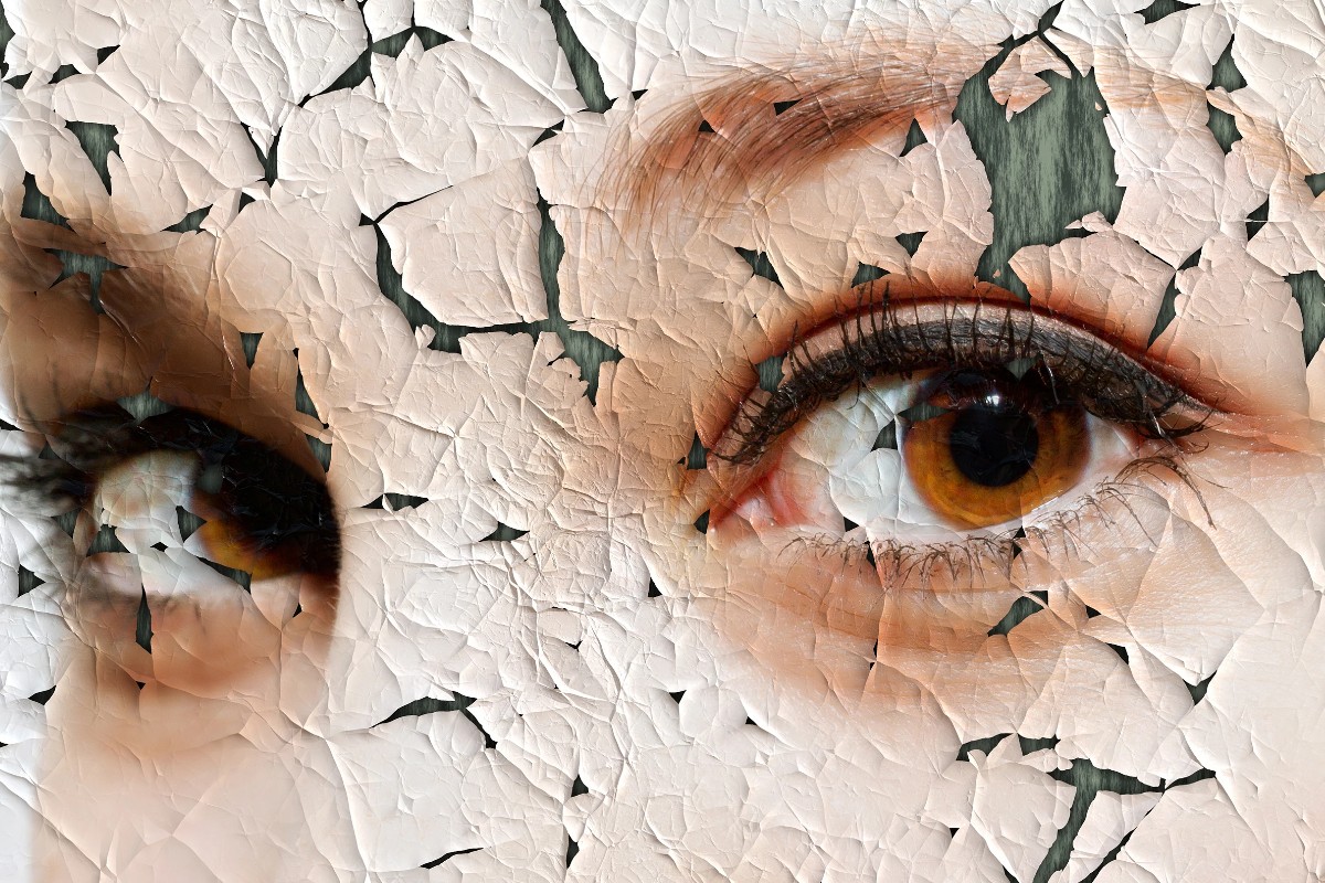 dry skin causes wrinkles